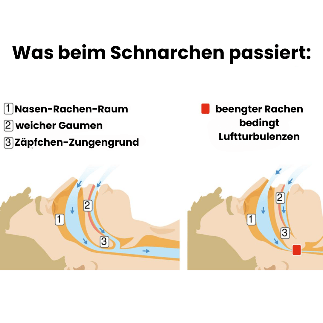 Nuraya Anti-Schnarch Mundstück